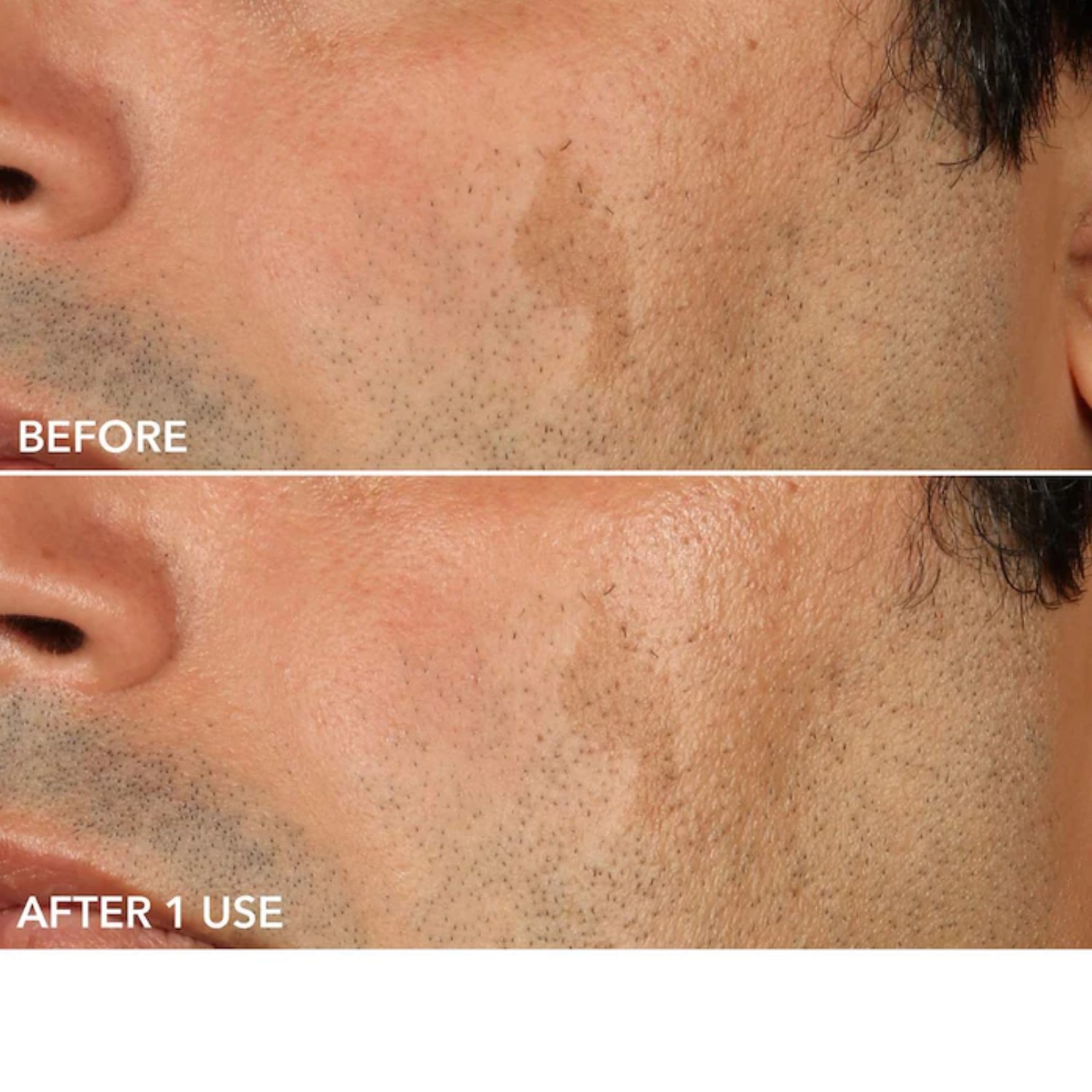 ADVANCED RETINOL + FERULIC PERFECTLY DOSED RETINOL EXTRA STRENGTH 0.5% (ALMOHADILLAS EXFOLIANTES CON RETINOL)